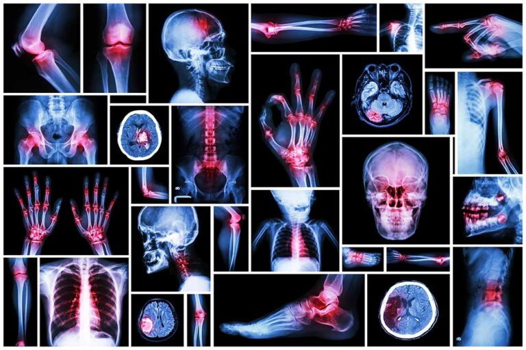 What Medical Evidence Helps a Disability Appeal? | The Moore Law Office | Social Security Disability Lawyers | Western North Carolina